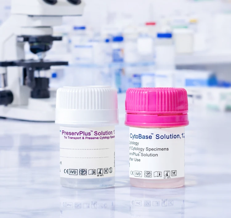 VitroPrep PreservPlus Solution/CytoBase Solution